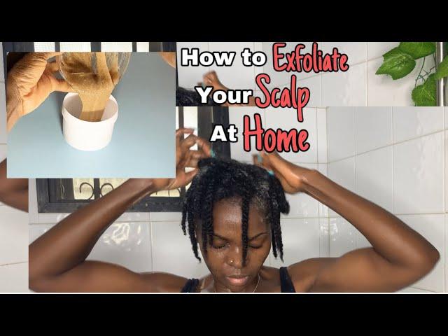 diy scalp scrub to grow your hair fastfix dandruff & all scalp issues #howto #scalpscrub #diy