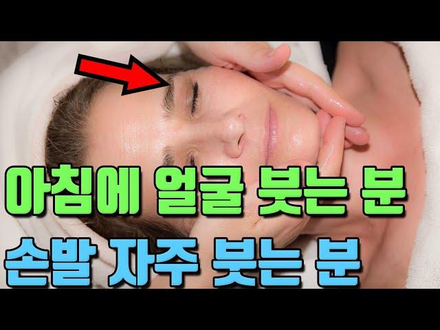 한번만 먹어도 붓기를 쫙 빼주는 이 것! (아침에 얼굴이 붓는 분, 손발이 자주 붓는 분 종아리가 아프신 분)