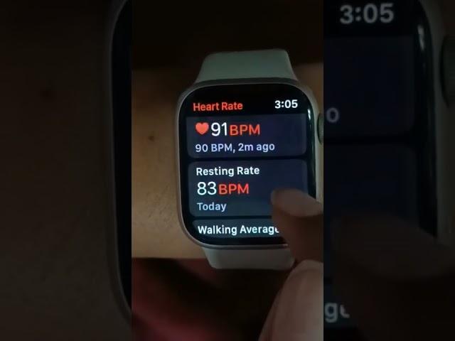 iWatch | Apple  watch | Heart Rate ️ | smartwatch @BlackEBoyTech