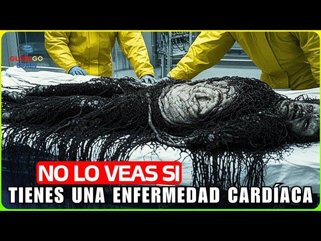 8 Personas Más FUERTEMENTE IRRADIADAS e INFECTADAS del Mundo que Romperán Tu Corazón – Documental