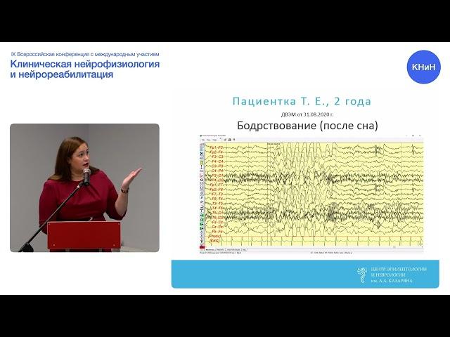 Н.Е. Кваскова. Эволюция электроэнцефалографической картины у пациентов с GLUT1. Случаи из практики