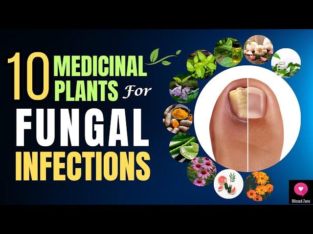 10 Medicinal Plants For Fungal Infections | Herbal Remedies | Blissed Zone