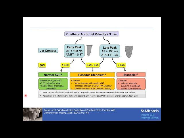 Echocardiographic Assessment of Prosthetic Aortic Valve Function