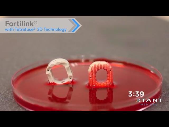 Xtant Medical: Fortilink® with Tetrafuse® 3D Technology