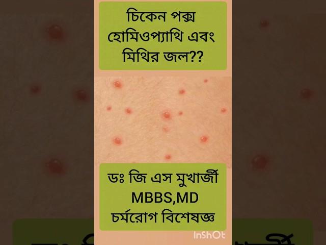 Chicken pox | #dermatologist #shorts #skinspecialist #doctor #health #bangla #skincareroutine