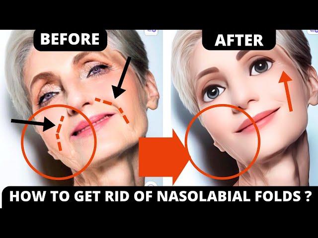  HOW TO GET RID OF NASOLABIAL FOLDS WITH FACE YOGA ? JOWLS, SAGGY SKIN, FOREHEAD LINES, FROWN LINES