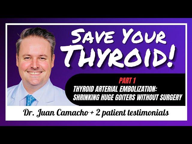 Thyroid Arterial Embolization in SARASOTA: Dr. Juan Camacho - #79 PART 1