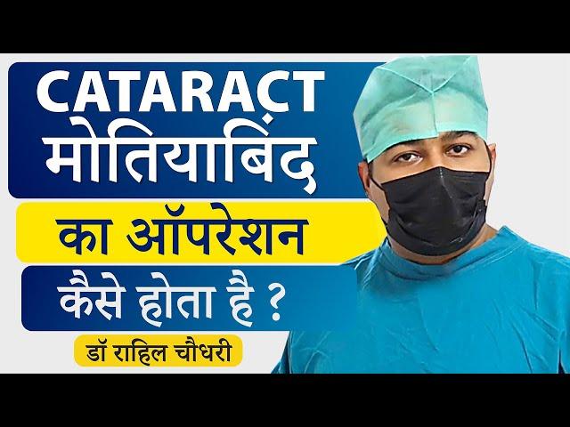 मोतियाबिंद (Cataract) का ऑपरेशन कैसे किया जाता है? | Step-By-Step Process of Cataract Surgery