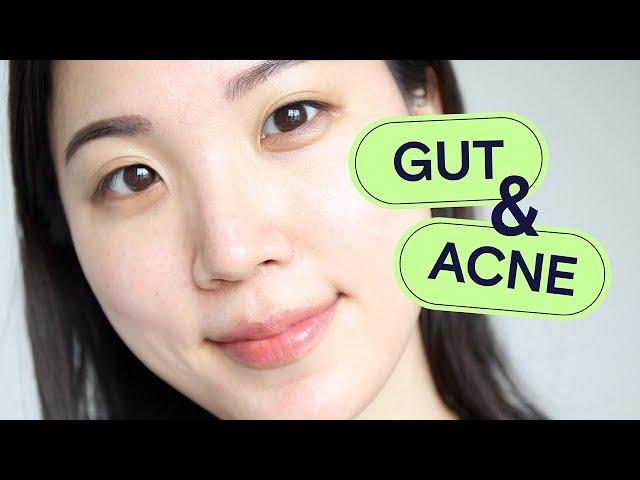 Why Gut Health is SO Important For Acne & How To Improve Gut Health For Glowing Skin | Acne School