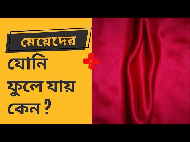 মেয়েদের যোনি ফুলে যায় কেন?