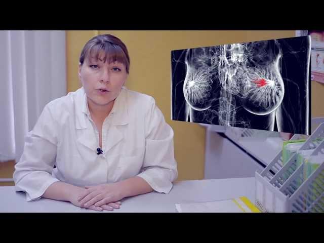 Как лечить рак груди? Говорит ЭКСПЕРТ.