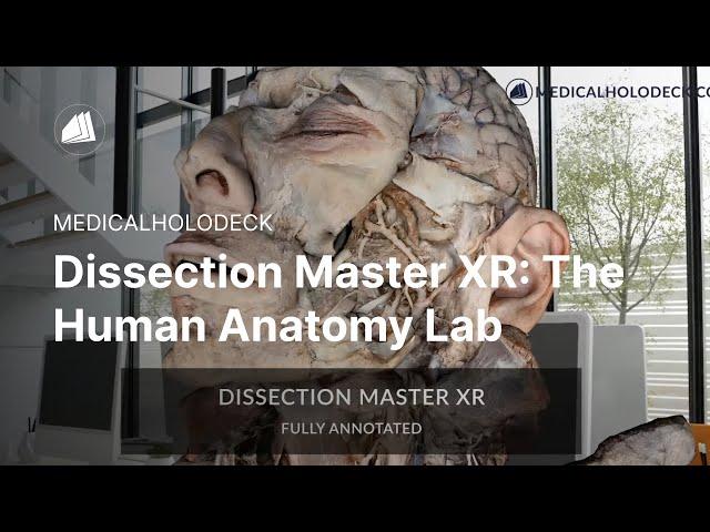 Why Medicalholodeck: The Human Anatomy Lab for VR & AR | Free Download