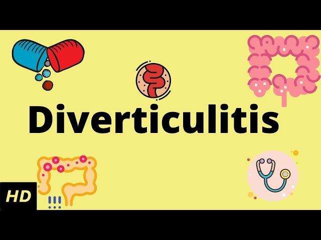 Diverticulitis, Causes, SIgns and Symptoms, Diagnosis and Treatment.