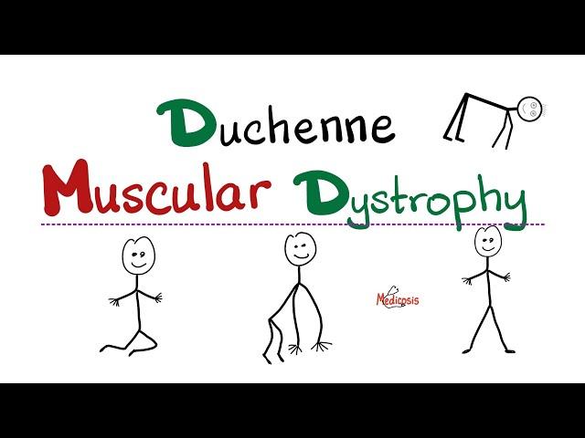 Duchenne Muscular Dystrophy (DMD) - Muscle Weakness