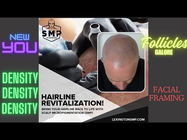 Scalp Micropigmentation at SMP of Lexington (Kentucky)