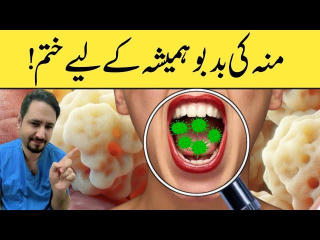 Halitosis - Bad Breath Solution Urdu Hindi - منہ کی بدبو ہمیشہ کے لیے ختم Dr.Irfan Azeem