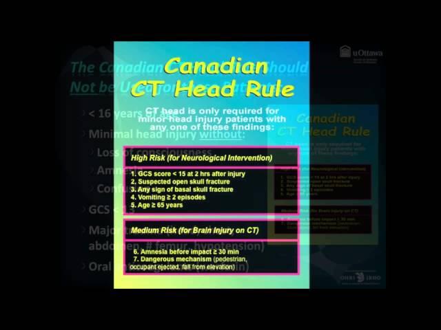 Canadian CT Head Rule by Dr. Ian Stiell