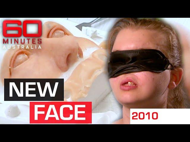 11-year wait for woman whose face was ripped off by a gun | 60 Minutes Australia