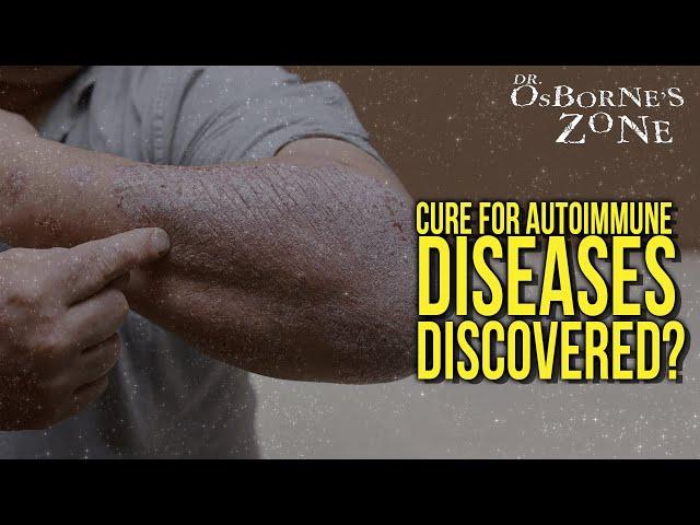 Cure for autoimmune diseases discovered? - Dr. Osborne's Zone
