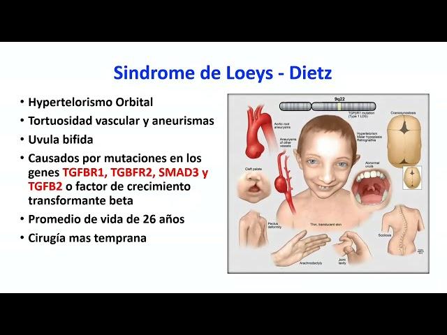 Cirugía Aórtica y Aortopatía