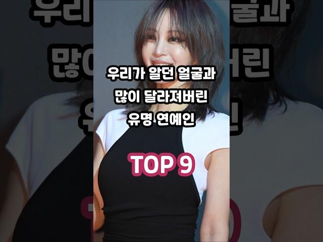 우리가 알던 얼굴과 많이 달라져버린 유명 연예인 TOP 9