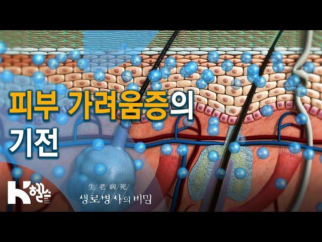 피부 가려움증의 원인은? - 726회(20.02.12) SOS! 피부가 보내는 구조신호