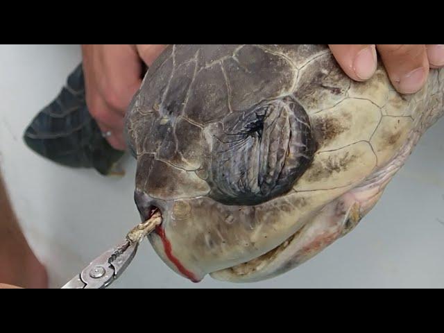 Plastic Straw Removed From A Sea Turtle's Nostril (Short Version)