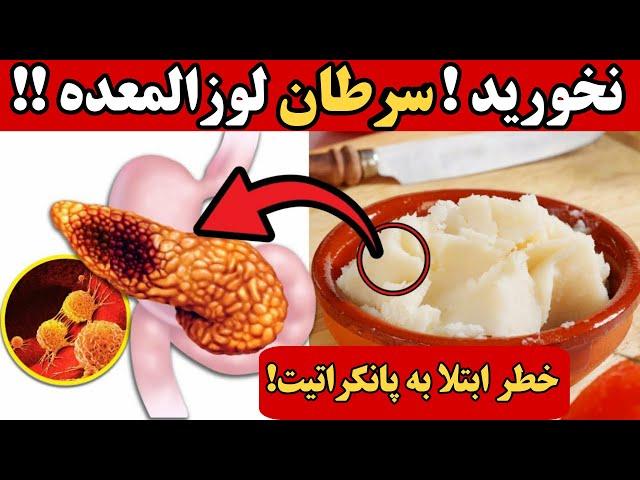 سرطان پانکراس | ۱۰ ماده غذایی خطرناک برای پانکراس ( خطر ابتلا به سرطان لوزالمعده )