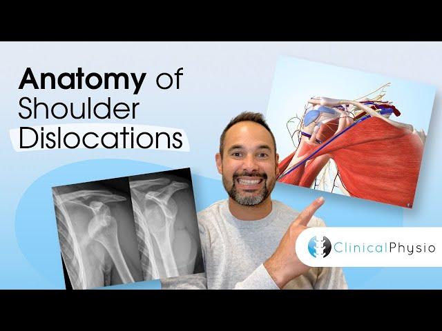 Shoulder Dislocation Anatomy | Expert Physio Guide