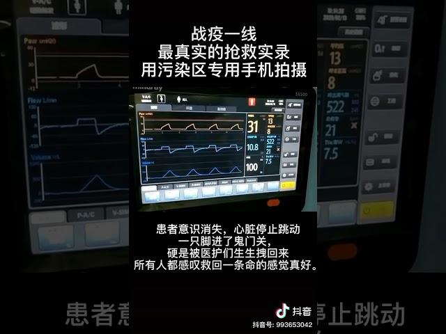 战疫一线真实抢救过程