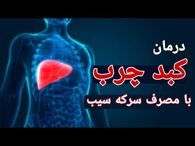 کبدچرب: درمان کبدچرب با مصرف سرکه سیب  #کبدچرب #سرکه_سیب #مسترسلامت