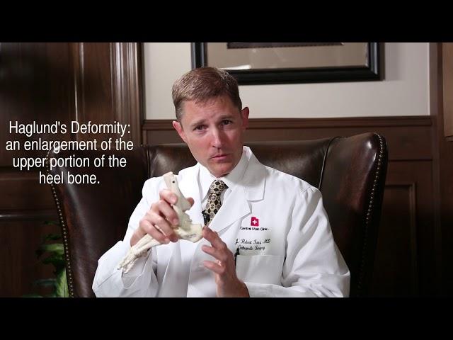 What causes Haglund's Deformity?