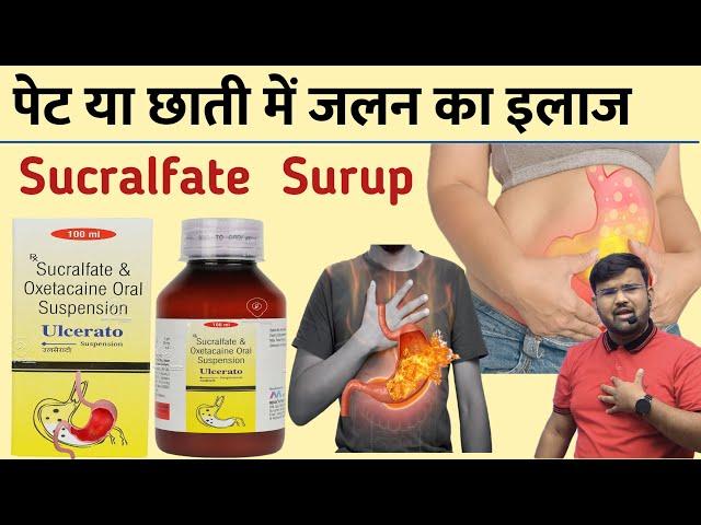 पेट और छाती में जलन | Sucralfate Syrup | Gastric Ulcer | Treatment | Medicine | Digestion | Ulcer