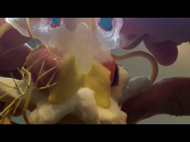 Medial Branch Model | Dynamic Disc Designs Corp.