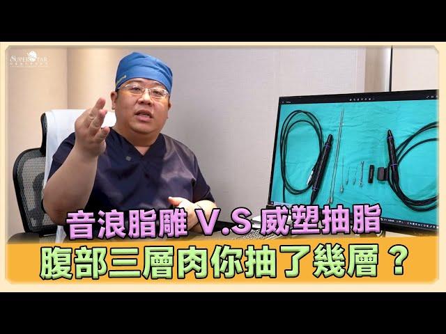 腹部抽脂心得分享! 腹部抽脂 音浪脂雕 vs 威塑抽脂 技巧大揭密! ｜林敬鈞醫師｜巨星整形外科