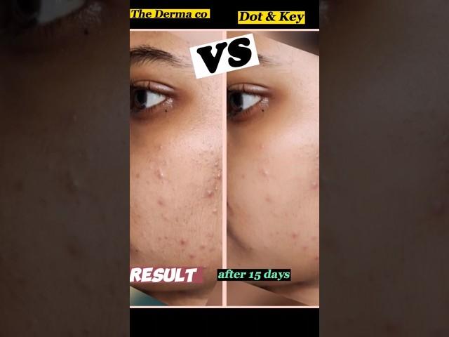 Dot & Key VS The Derma Co || #shorts #comparison #ashortaday #honestreview