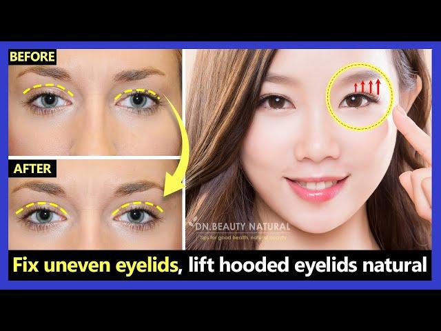 Only 2 mins!! How to Fix Uneven eyelids, Lift Droopy & Hooded eyelids naturally with Exercises.