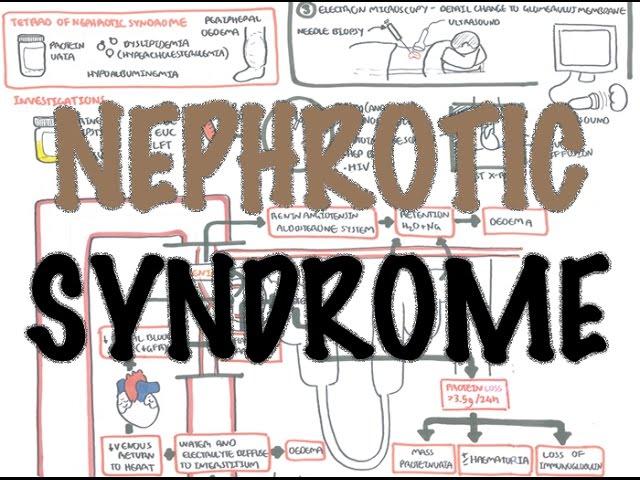 Nephrotic Syndrome - Overview (Sign and symptoms, pathophysiology)