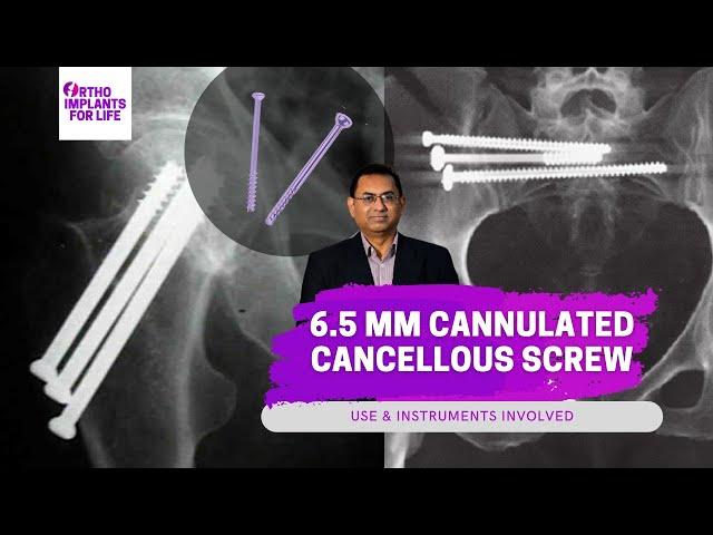 6.5mm Cannulated Cancellous Screws Related Instruments & Uses