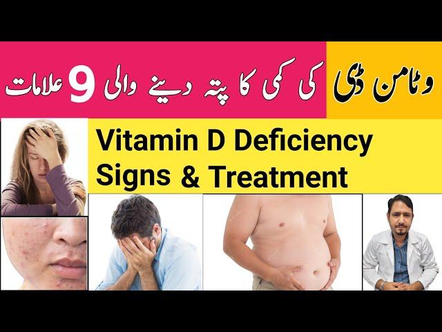 Vitamin D Deficiency Symptoms Test & Treatment Urdu Hindi - Dr Irfan Azeem