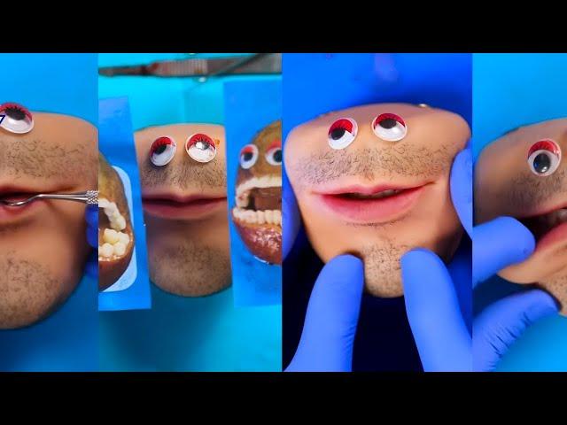 Fruit Surgery with Mr. Kiwi! Original Mr. Kiwi Episodes! Discount Dentist | TikTok | Fleeting Films