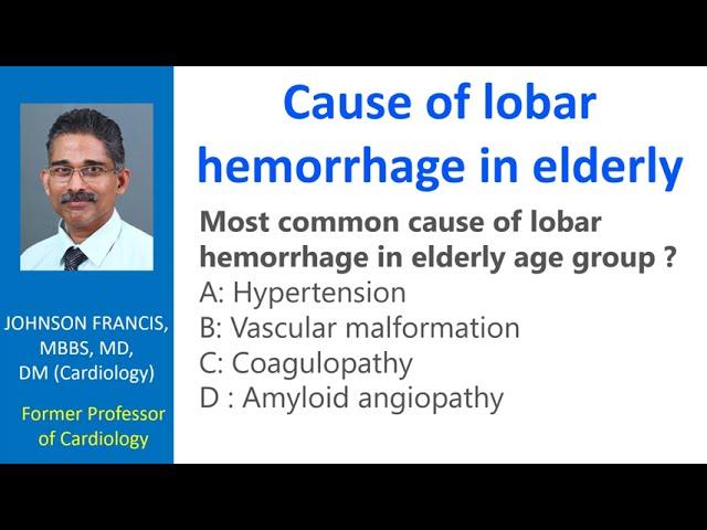 Cause of lobar hemorrhage in elderly