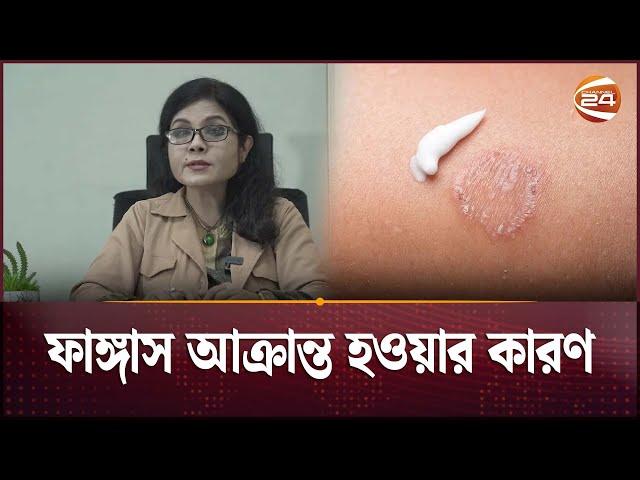 ফাঙ্গাস আক্রান্ত হওয়ার কারণ | Fungal Infection | Health Tips | Channel 24