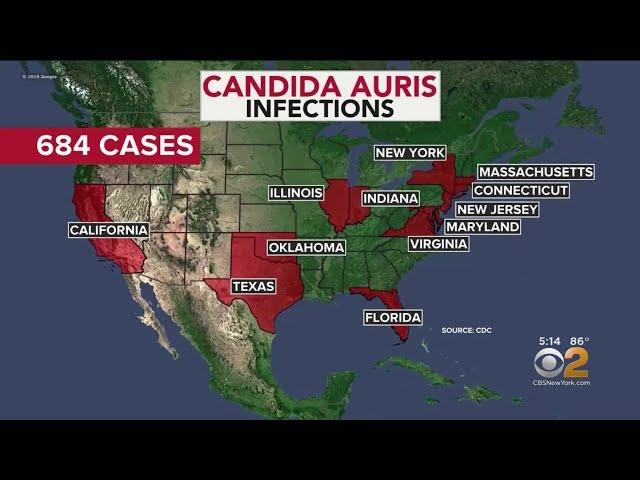 Researchers Learning More About Superbug Fungus Candida Auris