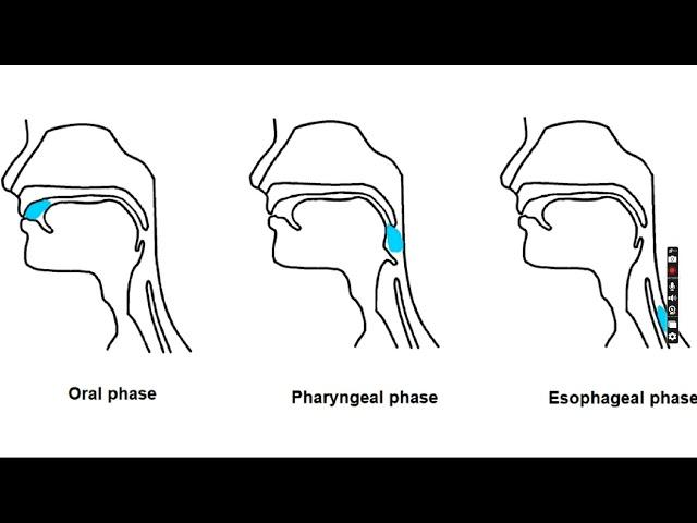 Swallowing Disorder specialist in Muzaffarpur, Check discription