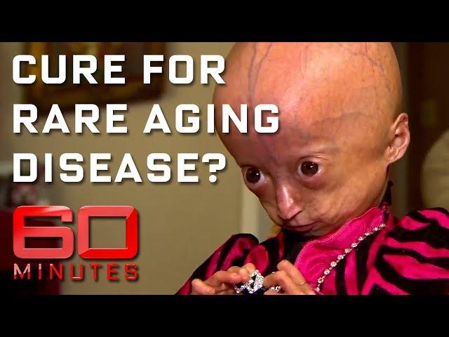 Rare disease ages children eight times faster | 60 Minutes Australia