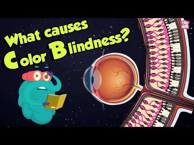 What Causes Color Blindness? | WhatIs COLOR BLINDNESS? | Dr Binocs Show | Peekaboo Kidz