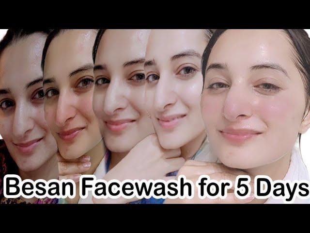 5 Days Skin Whitening Challenge | I Used Besan Magical Facewash and See What Happened