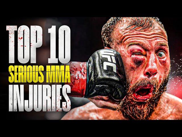 Top 10 SERIOUS MMA Injuries