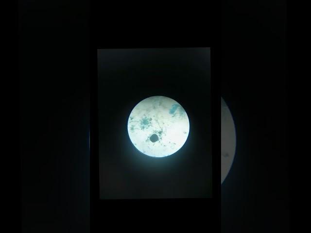 Practical//Mucor Fungi Microscopicview//#yt#ytshorts#practical#fungi#microscopicview#clg#video#viral